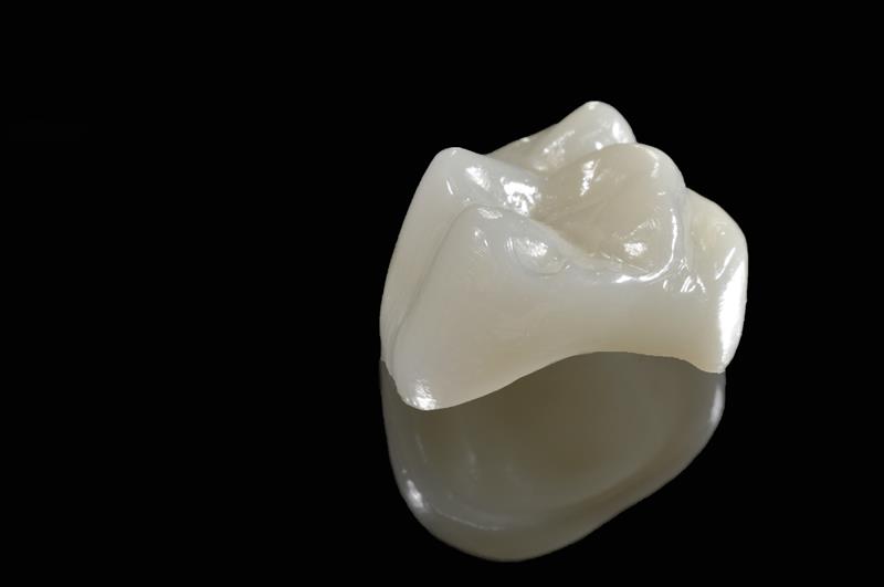 Porcelain Crowns  Elgin, IL